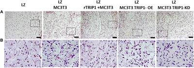 TRIP-1 Promotes the Assembly of an ECM That Contains Extracellular Vesicles and Factors That Modulate Angiogenesis